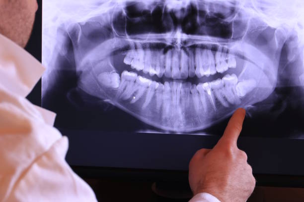 Best Chipped Tooth Repair Near Me  in Havelock, NC