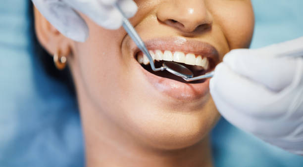 Best Chipped Tooth Repair Near Me  in Havelock, NC